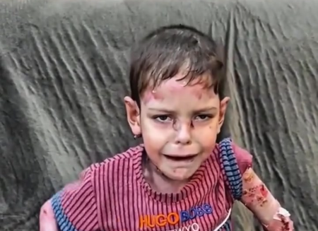 Arthur sorrindo, uma criança de 8 anos diagnosticada com Síndrome de Kleefstra